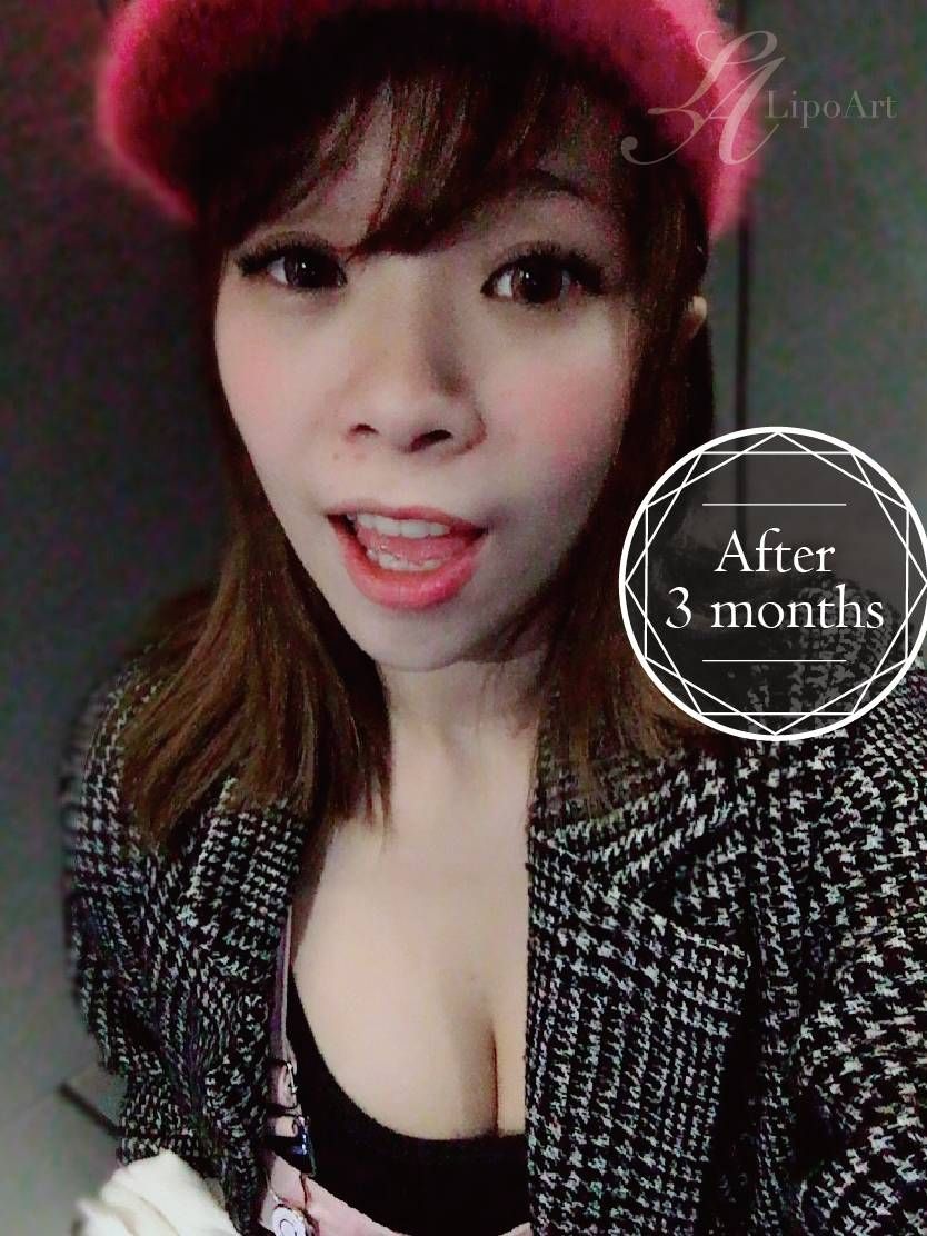萊波亞