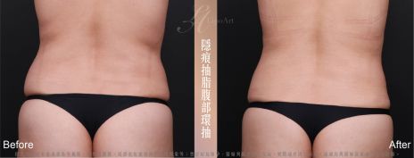 萊波亞 