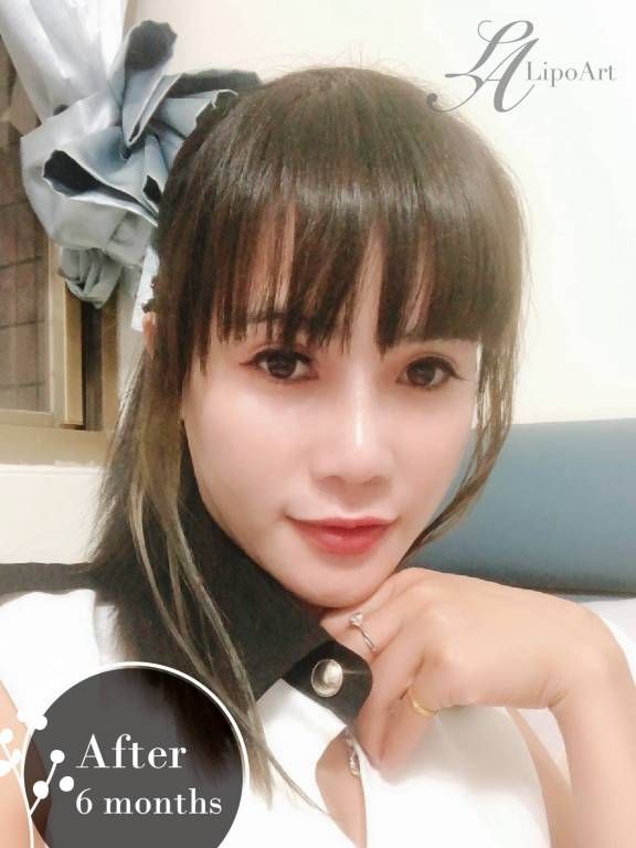 萊波亞