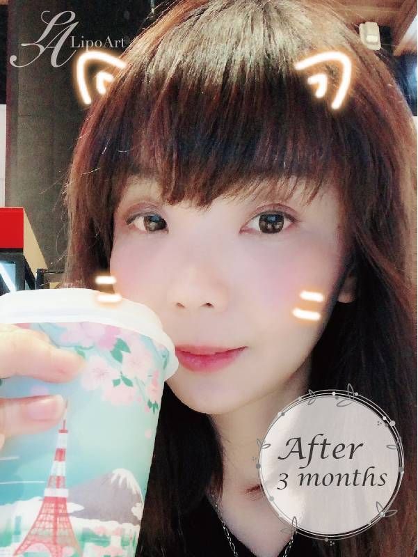 萊波亞