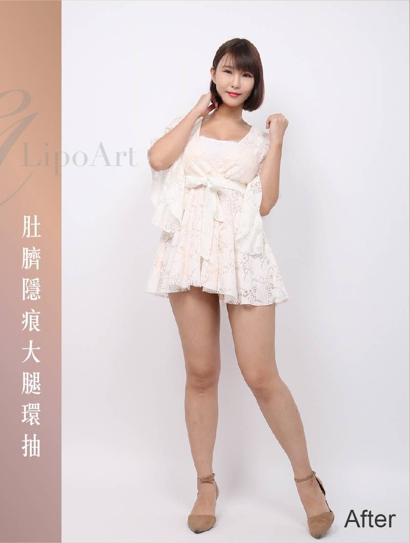 萊波亞 