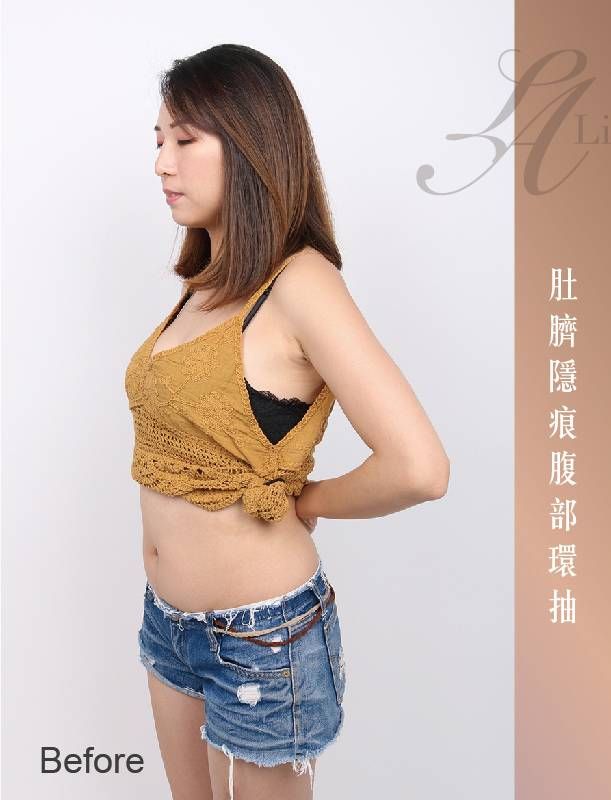 萊波亞