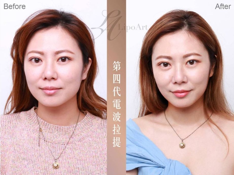 萊波亞