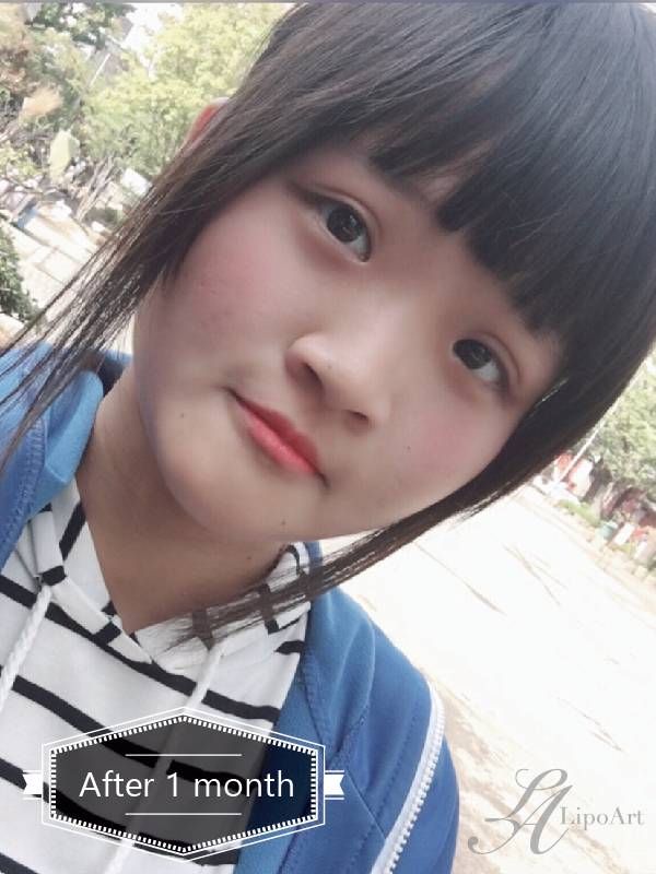 萊波亞