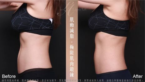 萊波亞 