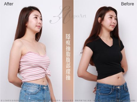 萊波亞 