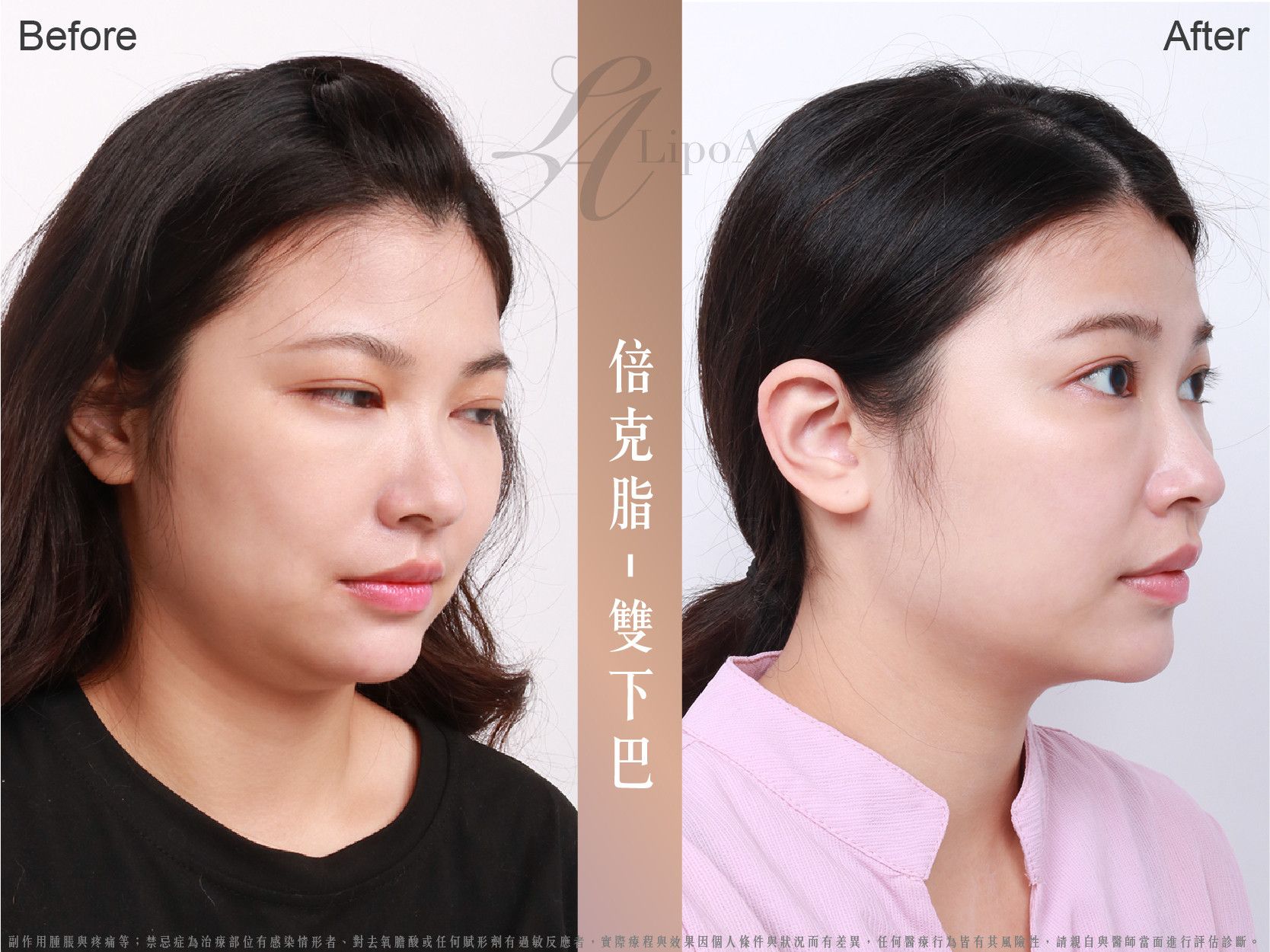 萊波亞 