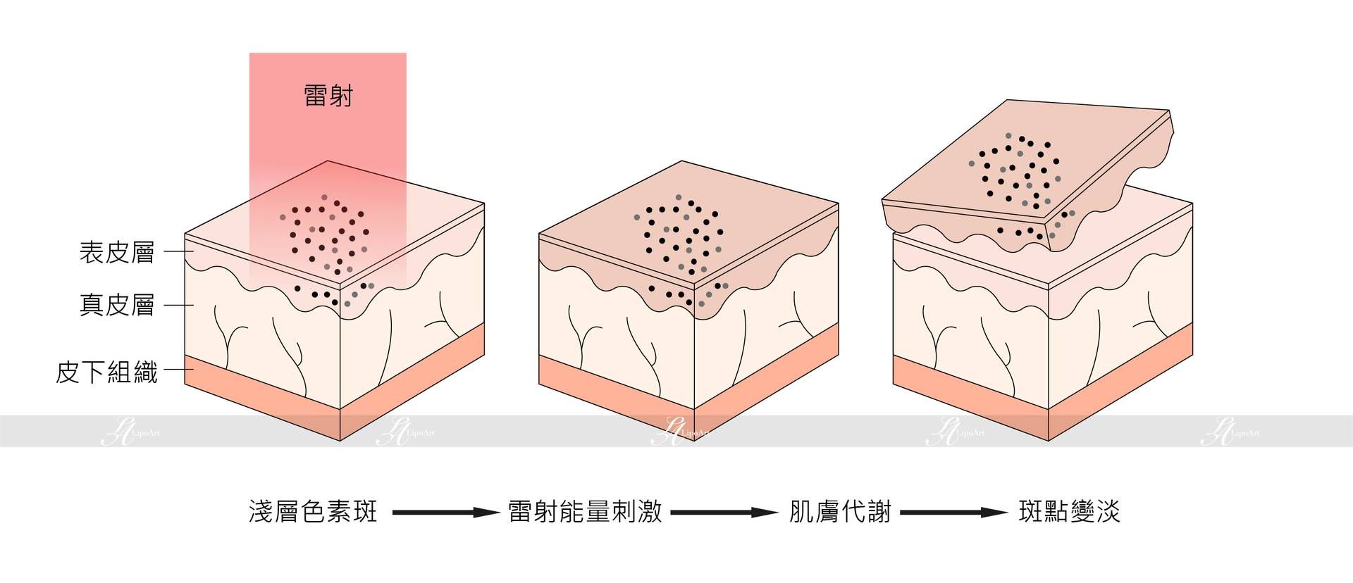 萊波亞