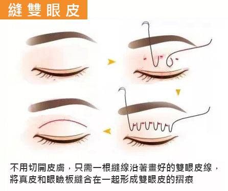 萊波亞