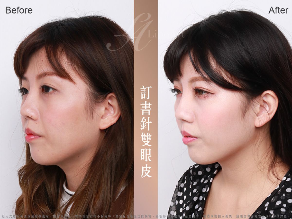 萊波亞