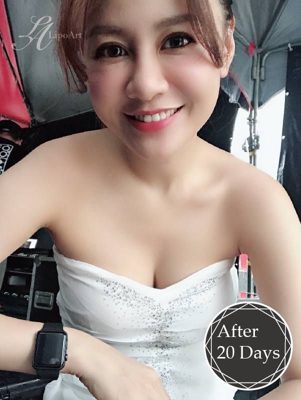 萊波亞