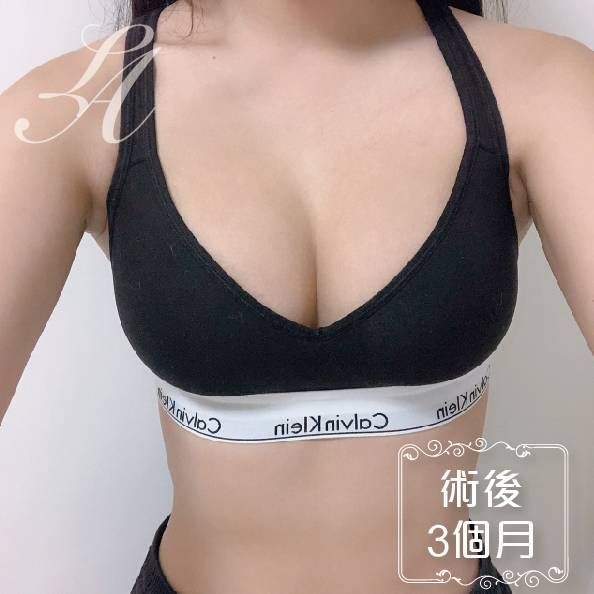 萊波亞