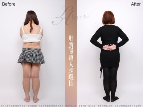 萊波亞