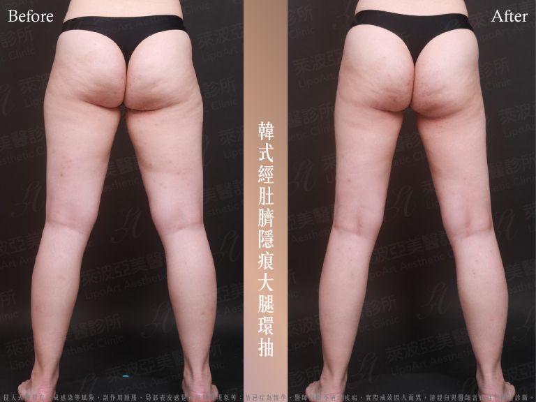 萊波亞