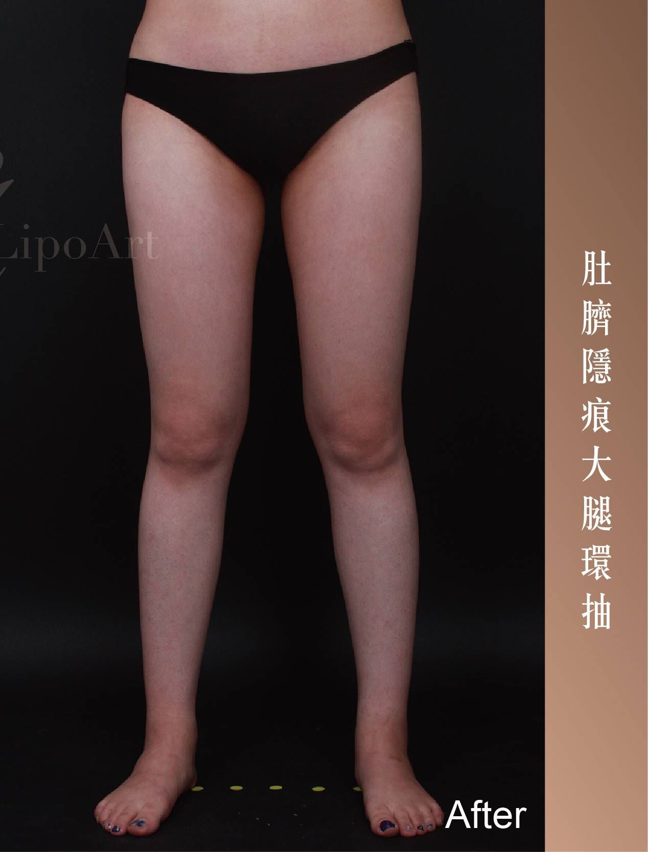 萊波亞 