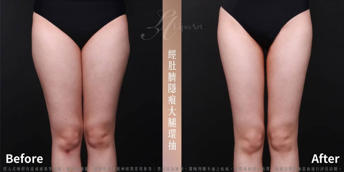 萊波亞