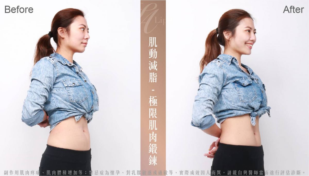 萊波亞
