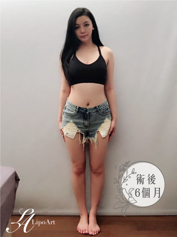 萊波亞