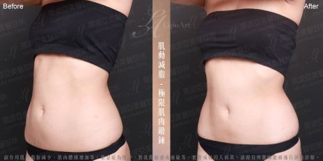 萊波亞