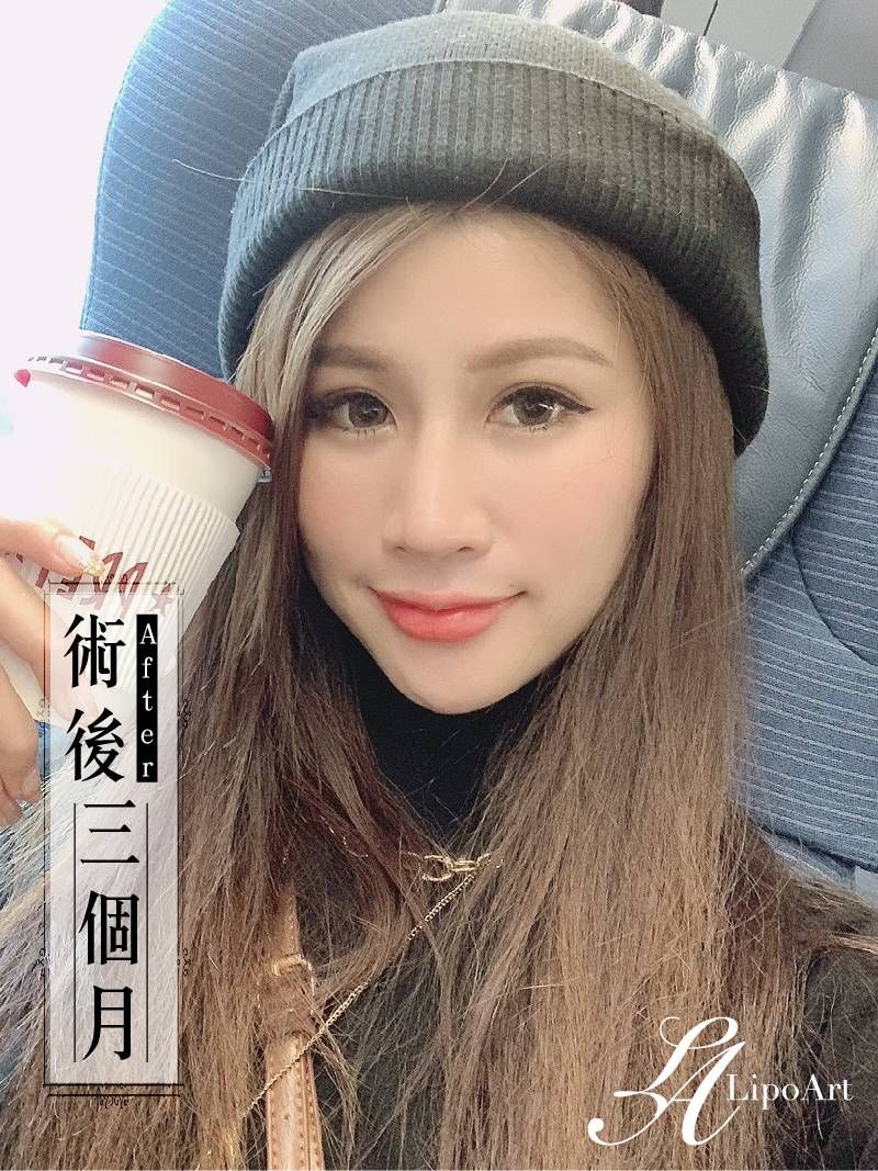 萊波亞