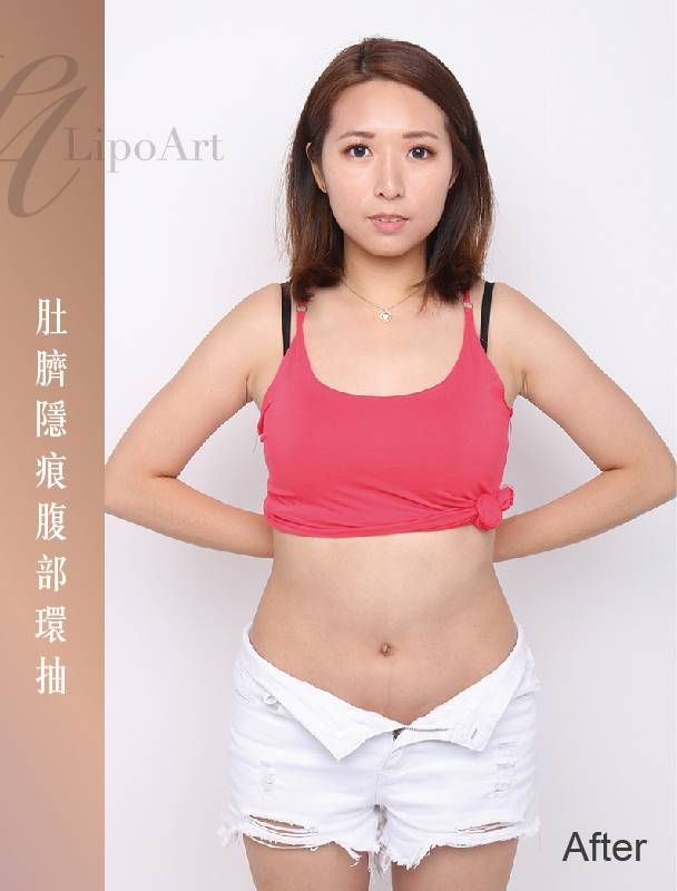 萊波亞