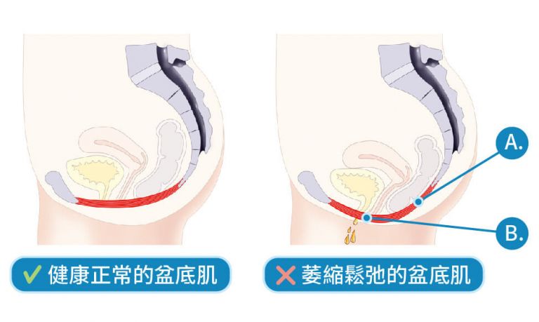 萊波亞