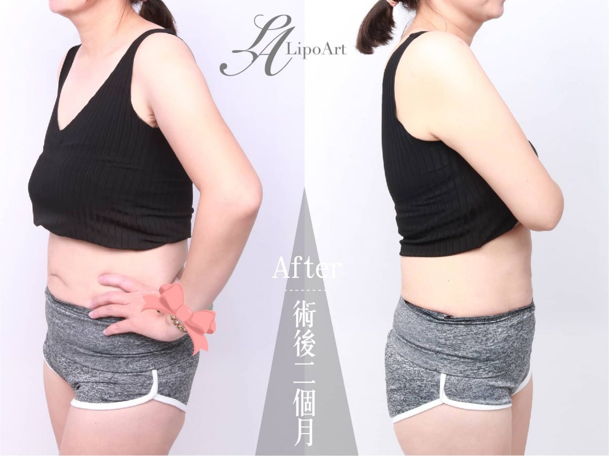 萊波亞