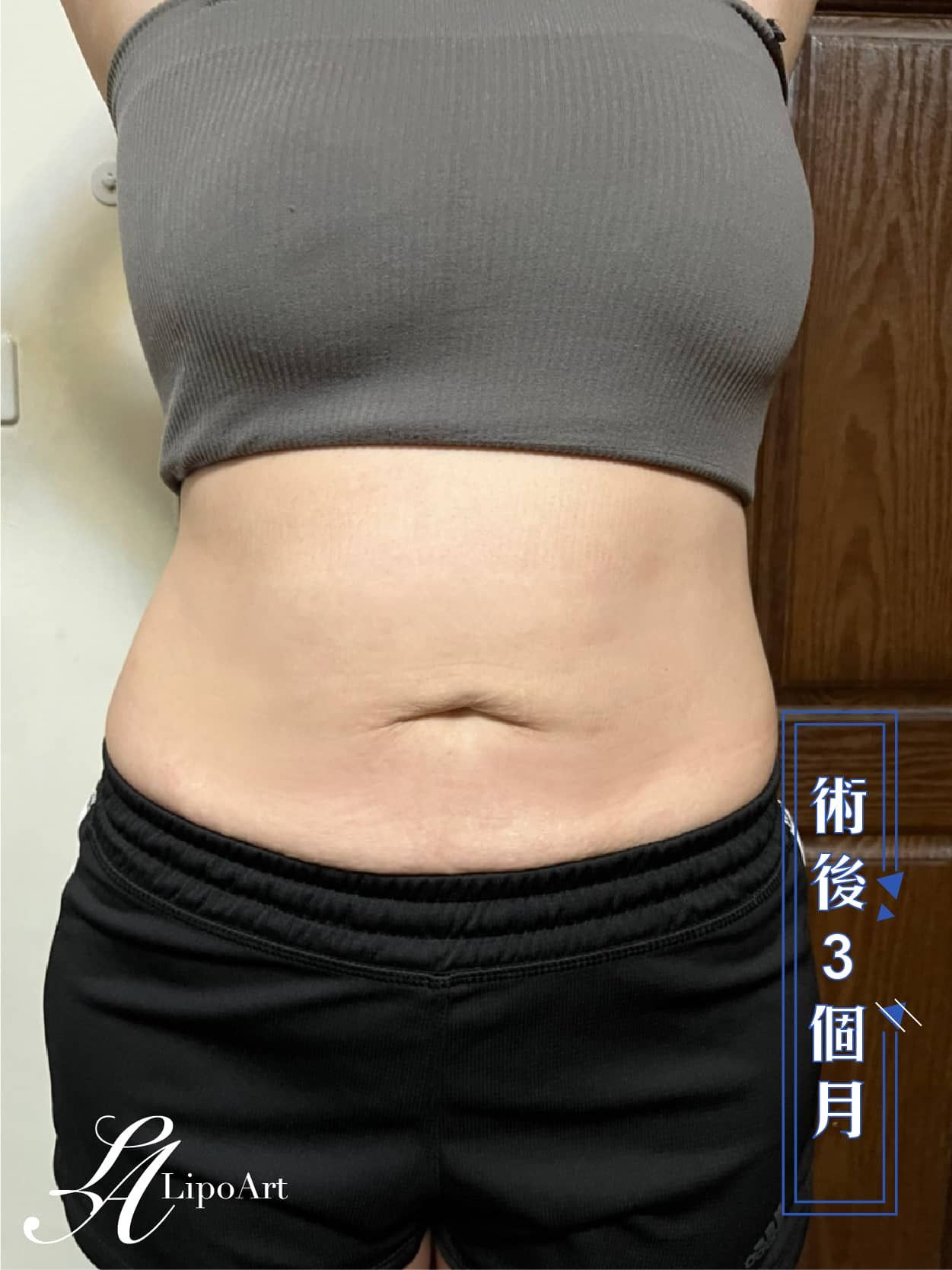 萊波亞