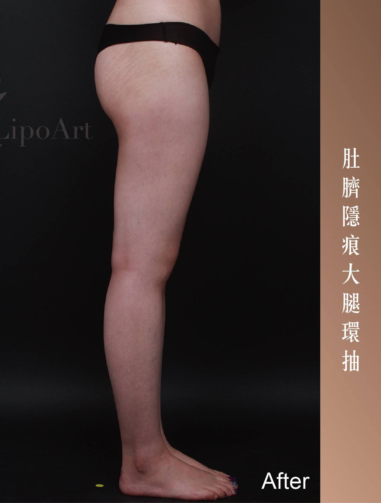 萊波亞 