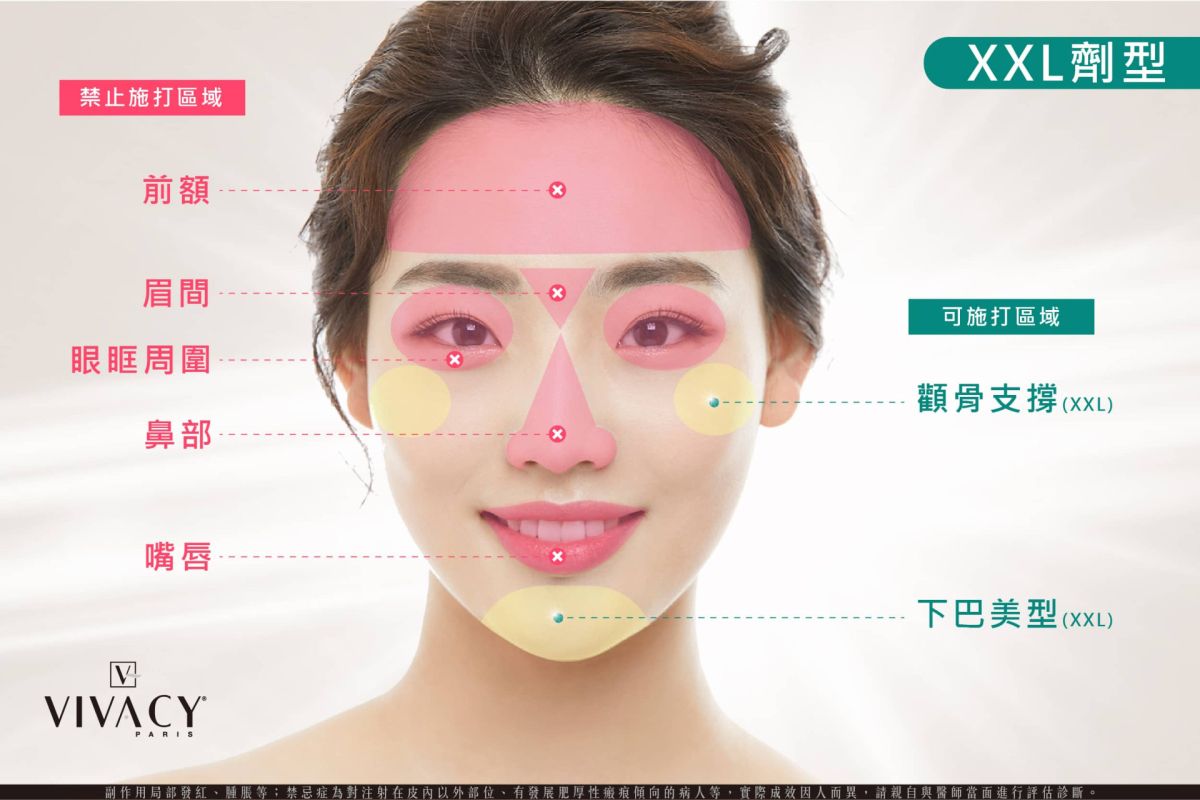 萊波亞