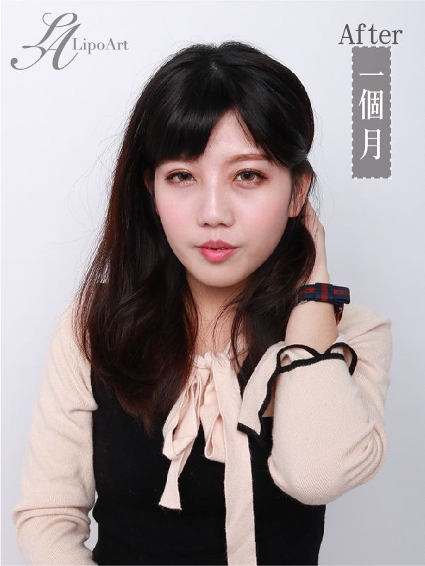 萊波亞