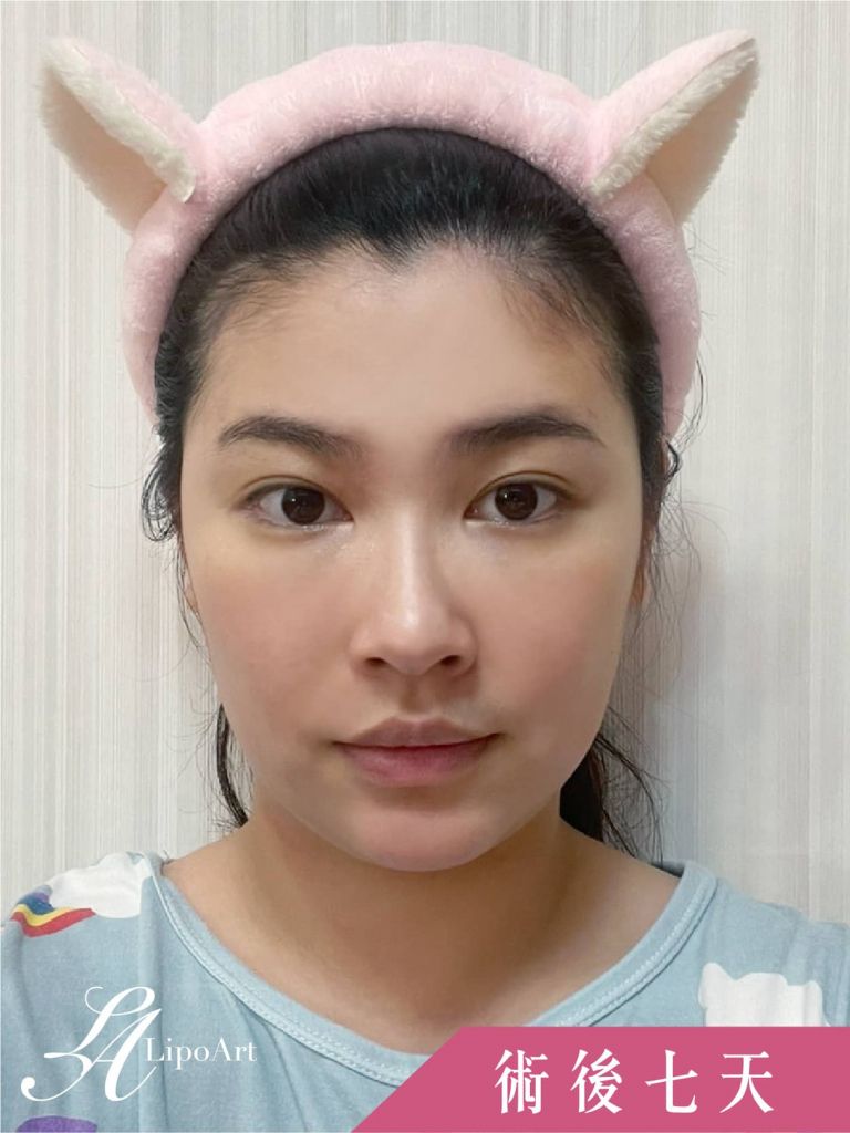 萊波亞