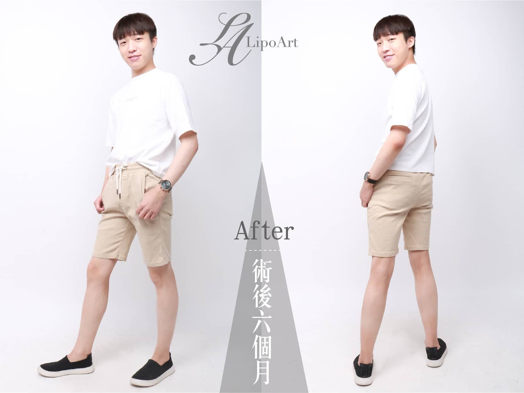 萊波亞