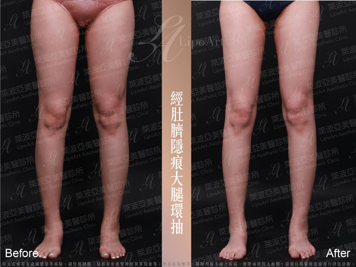 萊波亞