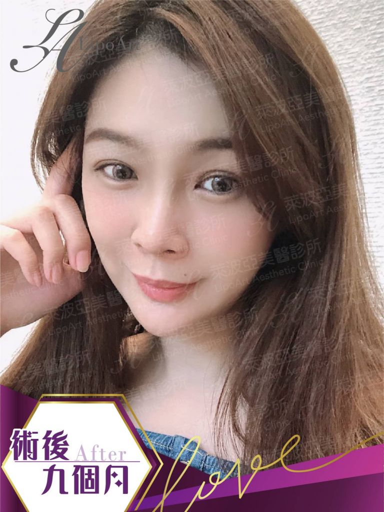 萊波亞