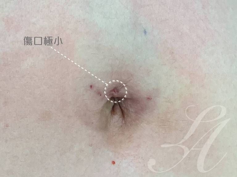 萊波亞