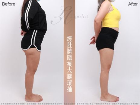 萊波亞 