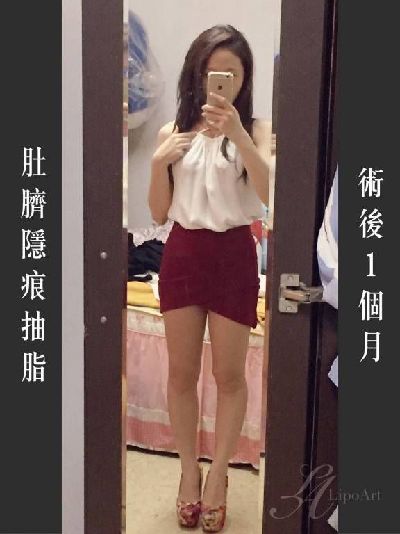 萊波亞