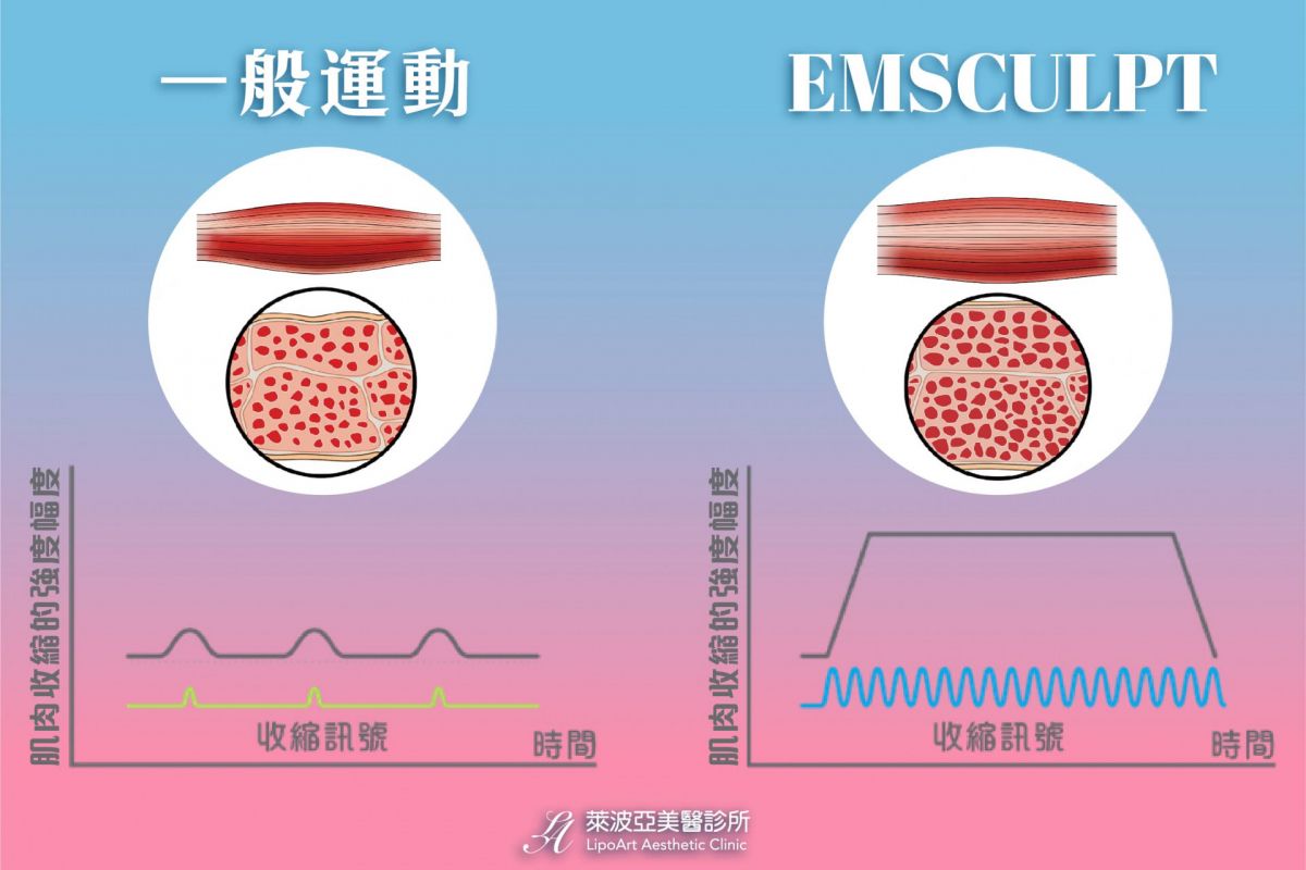 萊波亞