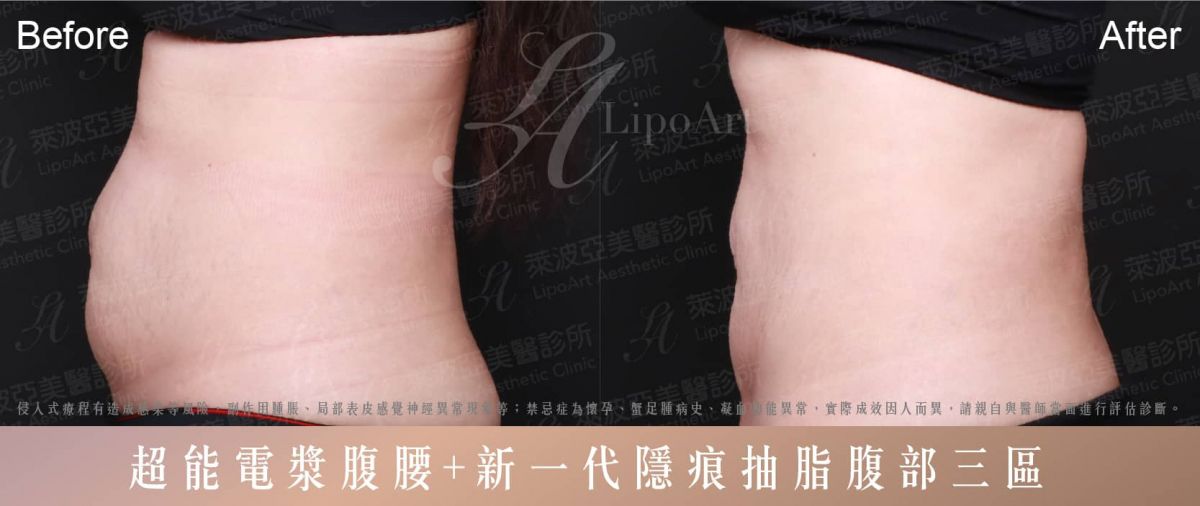 萊波亞