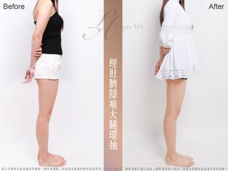 萊波亞 