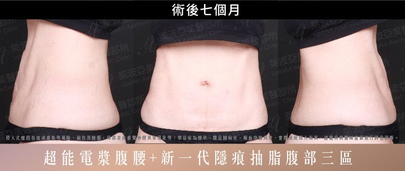 萊波亞