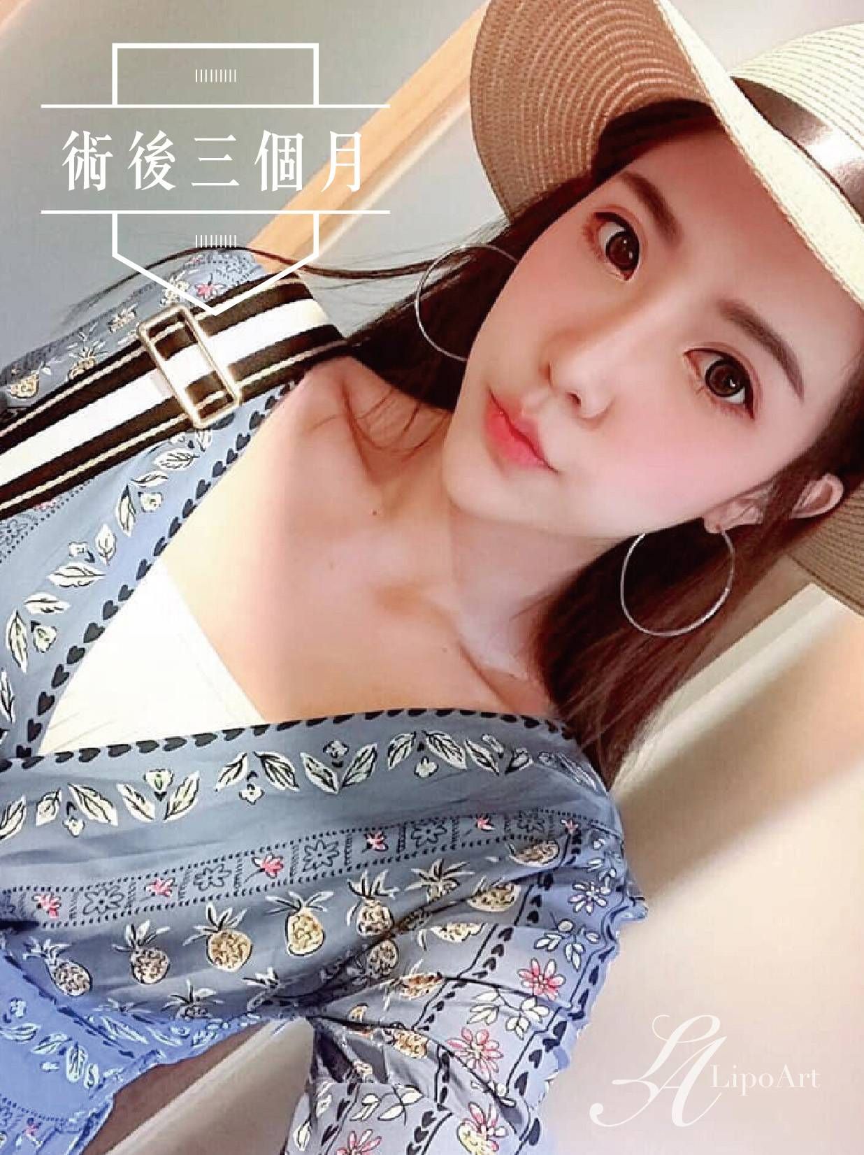 萊波亞