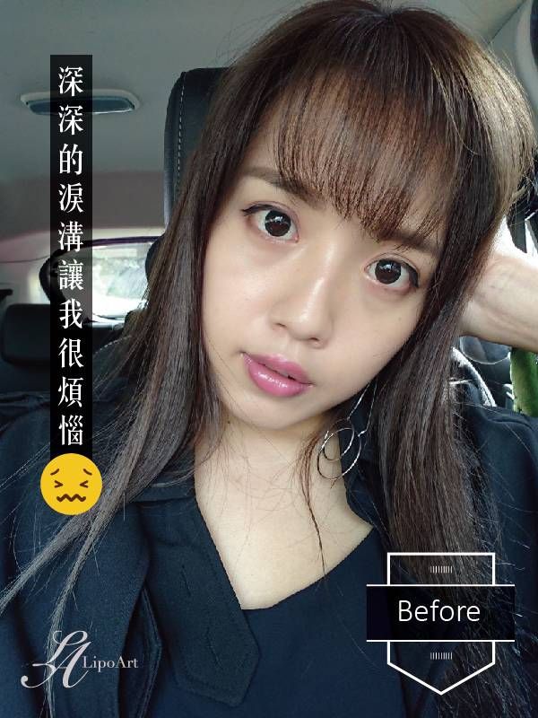 萊波亞