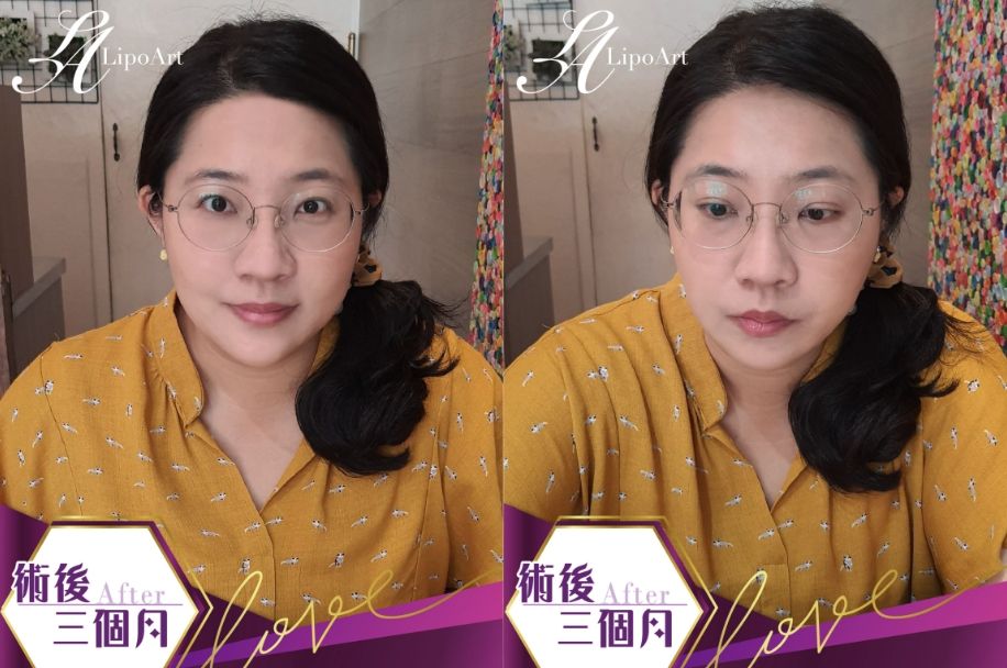 萊波亞