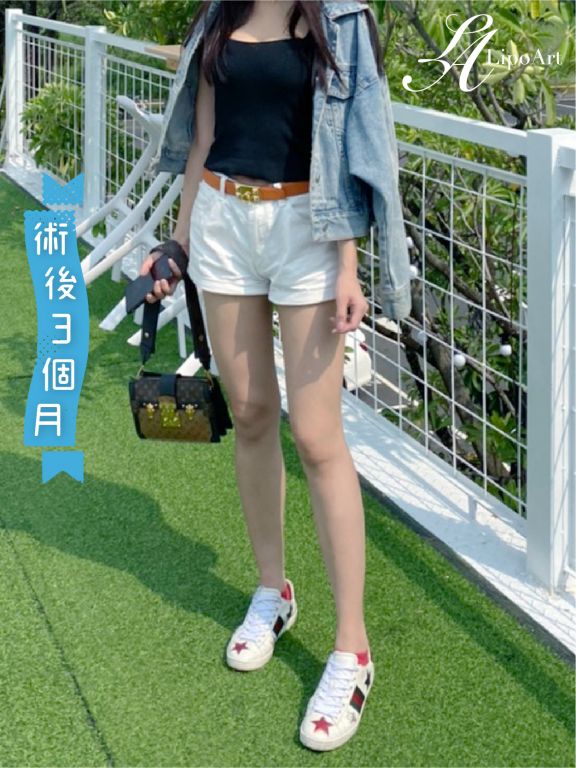 萊波亞