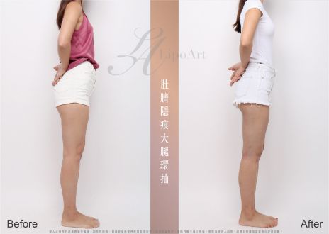 萊波亞 