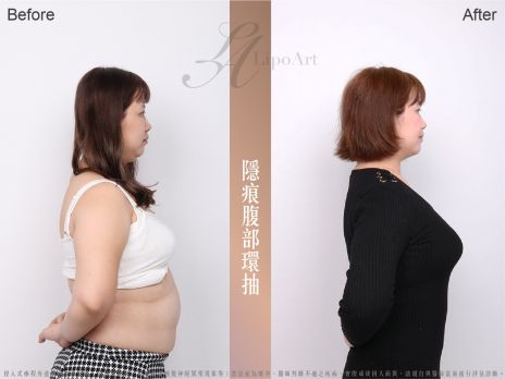 萊波亞
