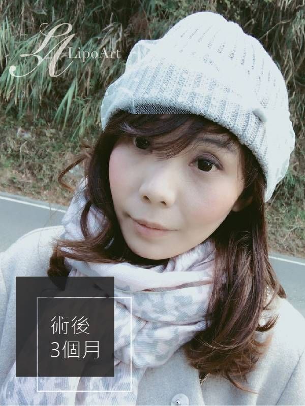 萊波亞