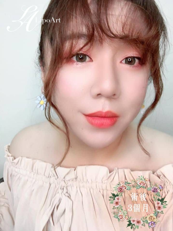萊波亞